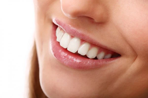 Smile Makeover The Top 5 Cosmetic Dentistry Procedures for a Brilliant Smile