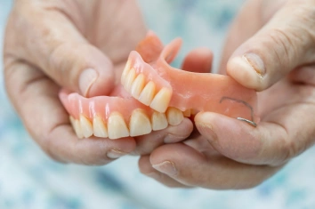 Implant Supported Dentures