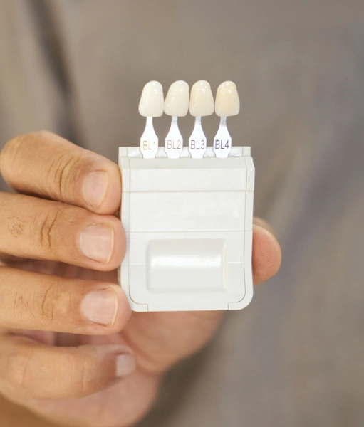 Porcelain Veneers